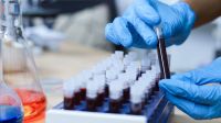 Câncer de próstata: exame de sangue pode prever tempo de sobrevivência