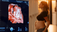 Isabel Veloso mostra ultrassom de primeiro filho: "Lindo demais"