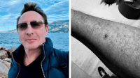Filho de John Lennon passa por cirurgia de emergência após descobrir câncer